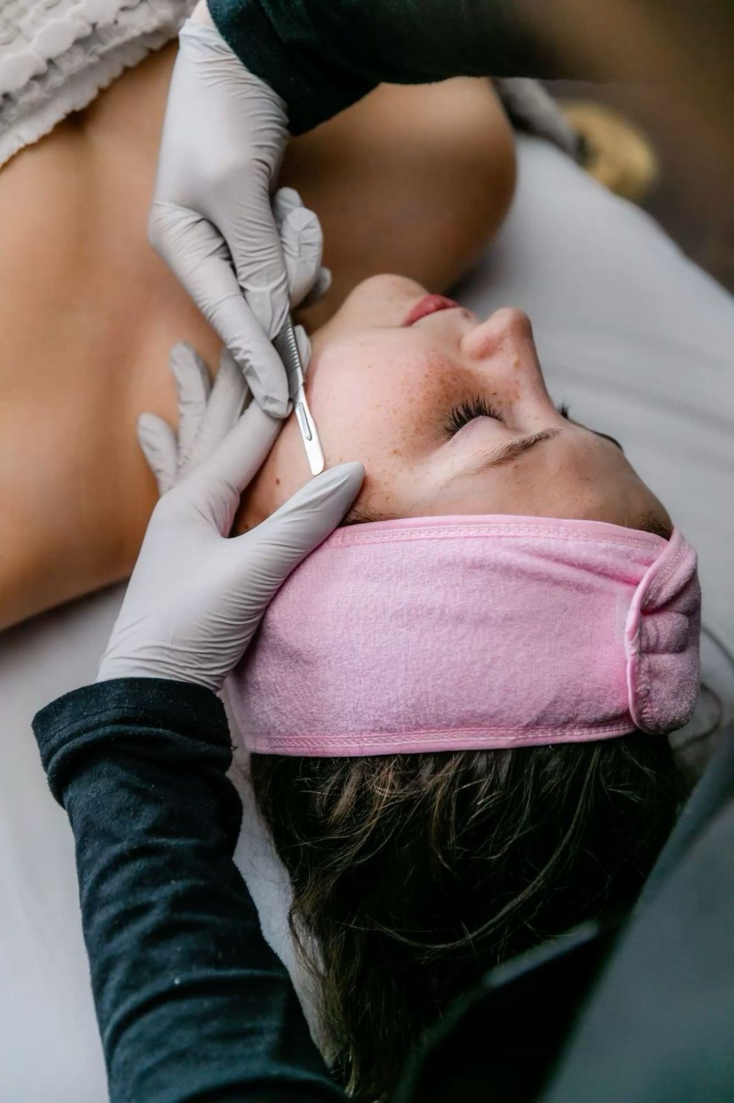 Dermaplaning